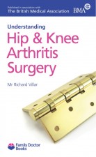 Understanding  Hip + Knee Arthritis Surgery